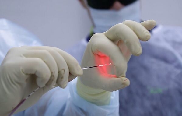 Fibra laser