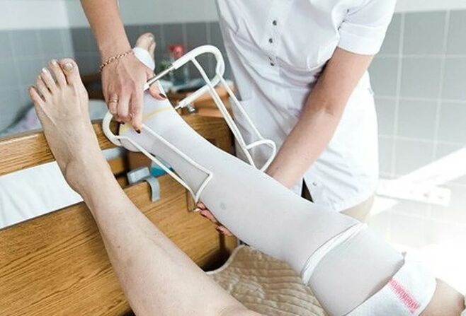 Periodo postoperatorio dall'intervento chirurgico sulle vene delle gambe
