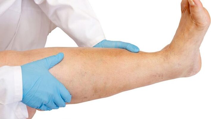 come identificare la malattia